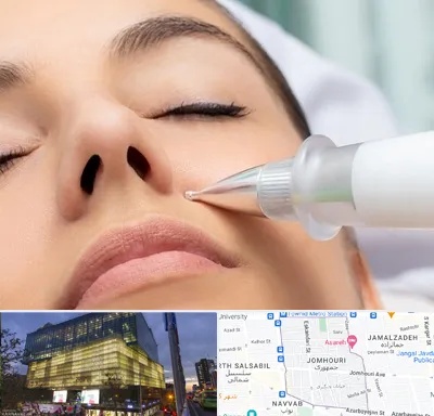 پلاسما جت بینی در جمهوری 