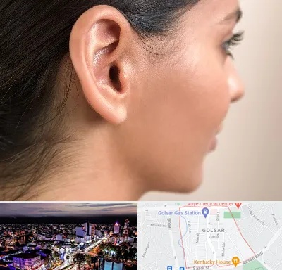 عمل گوش بل در گلسار رشت 