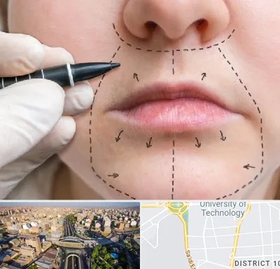 عمل سانترال لب در استاد معین 