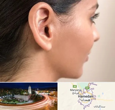 عمل گوش بل در همدان
